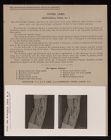 Upper Limb. Antecubital Fossa no. 2
